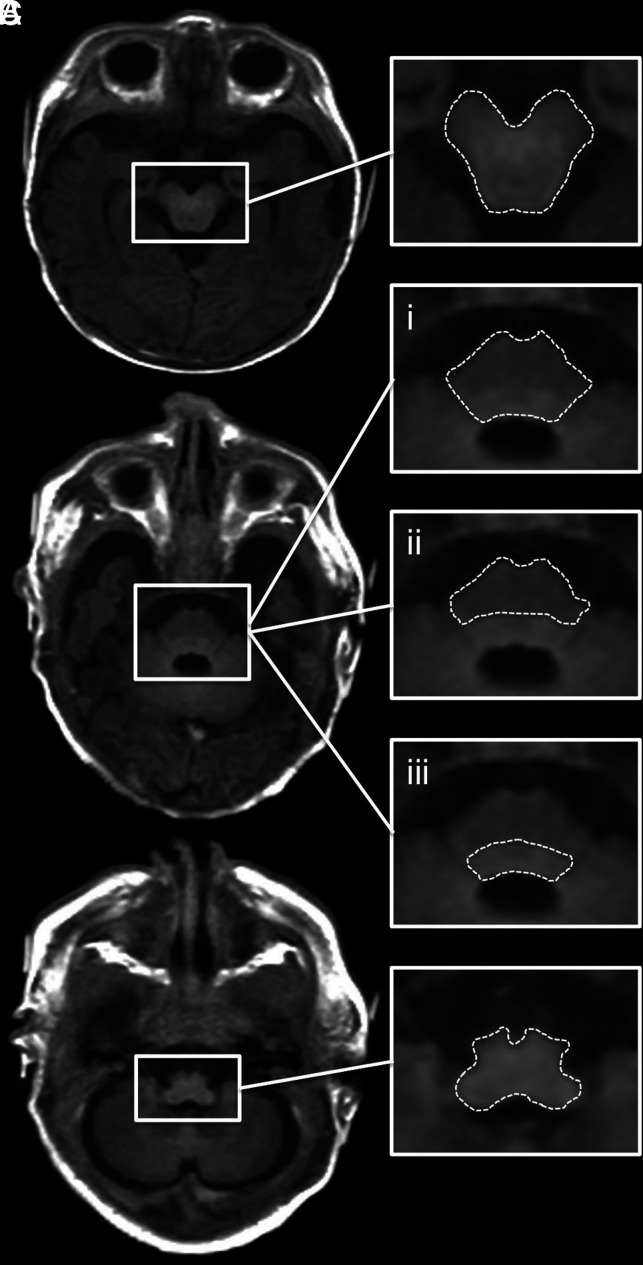 FIG 1.