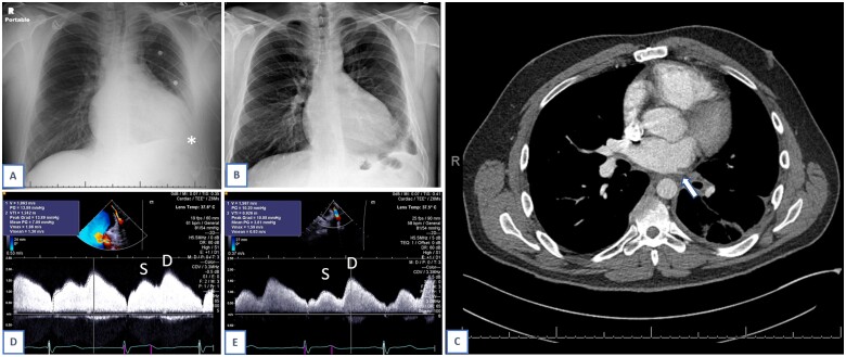 Figure 1: