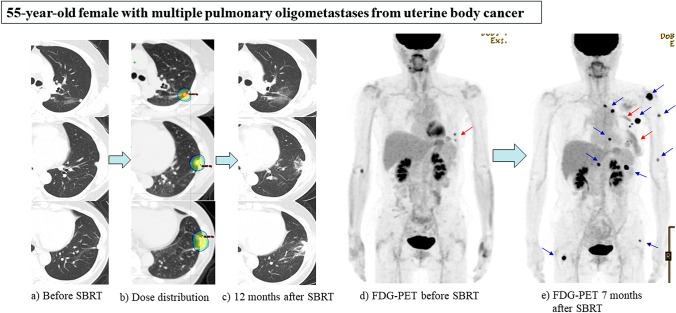 Fig. 3 A