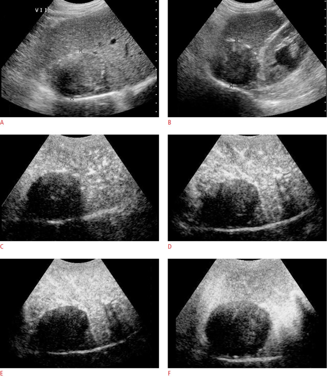 Fig. 12.