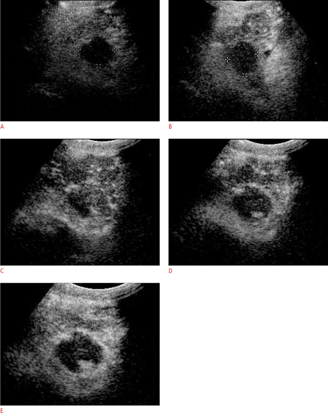 Fig. 11.