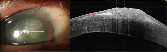 Fig. 6