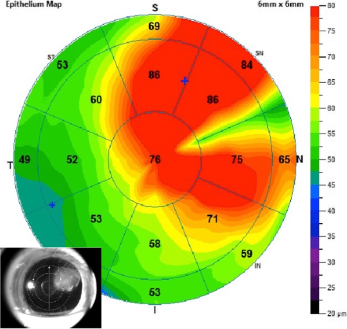 Fig. 4