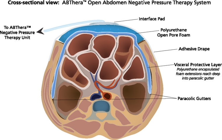 Fig. 2