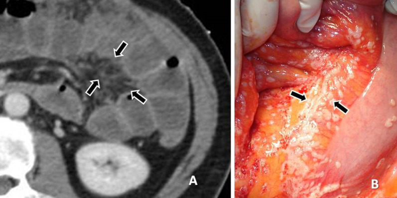 Fig. 11