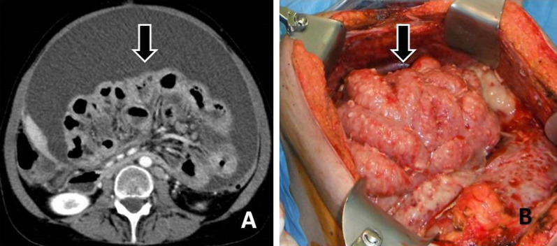 Fig. 15