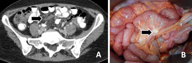 Fig. 14