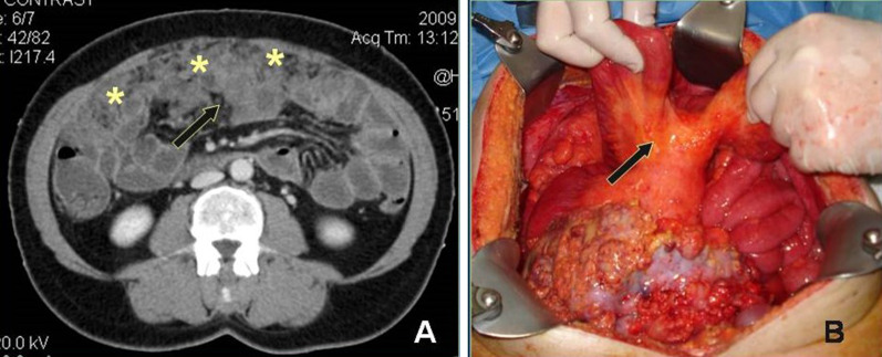 Fig. 12