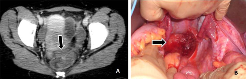 Fig. 4