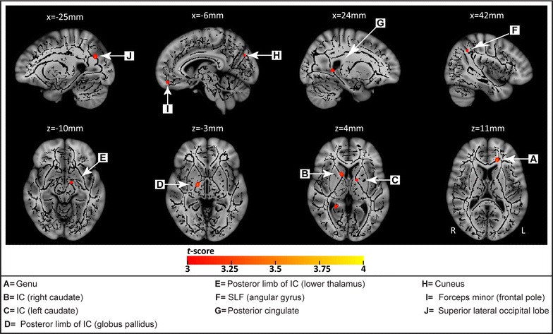 Fig. 2