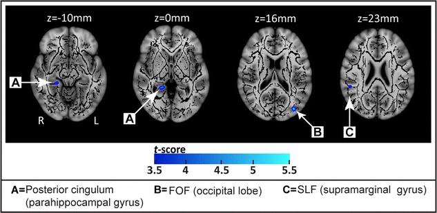 Fig. 1