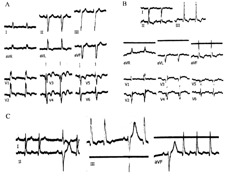 Fig. (2)