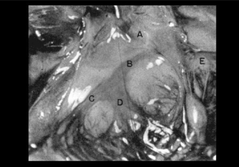 Fig. (1A)