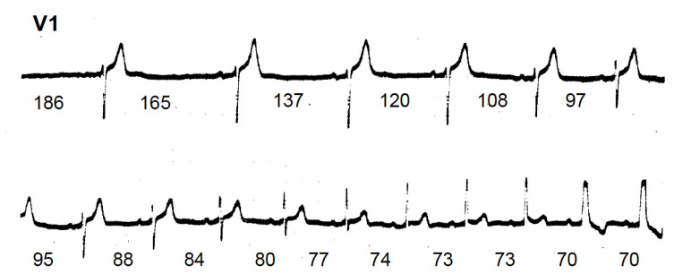 Fig. (5)