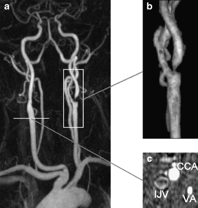 Fig. 2