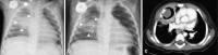 Fig. 5