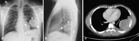 Fig. 12