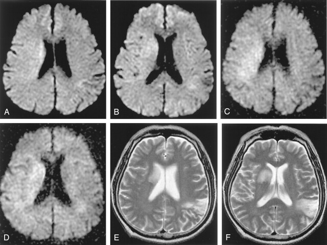 Fig 3.