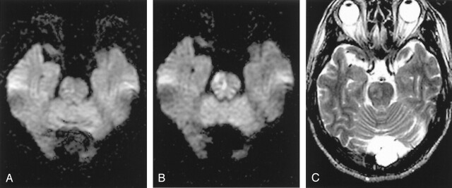 Fig 4.