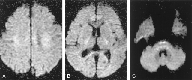 Fig 6.