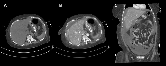 Fig. 5