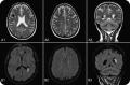 Fig 3.