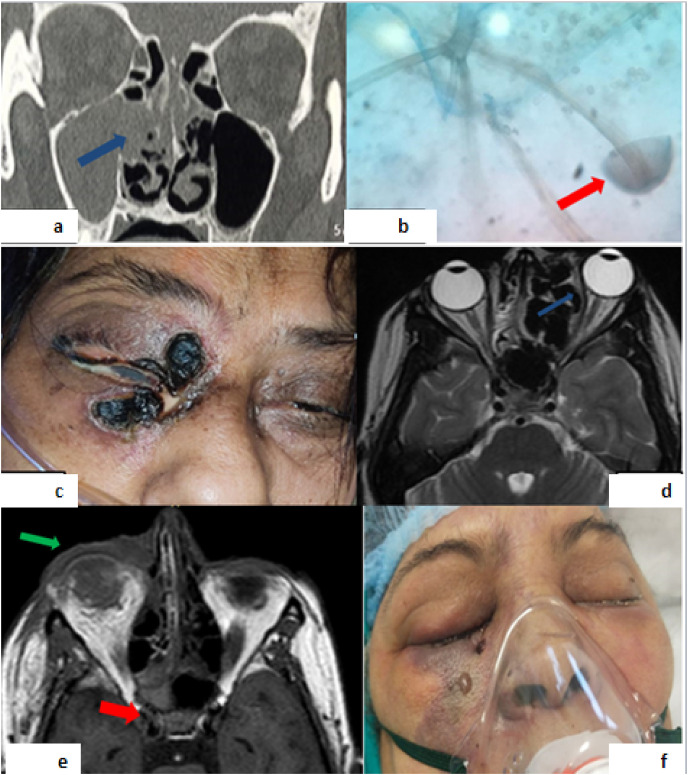 Fig. 1