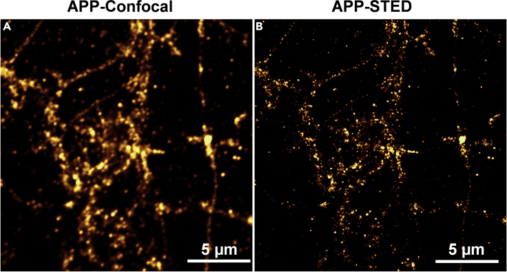 Figure 12