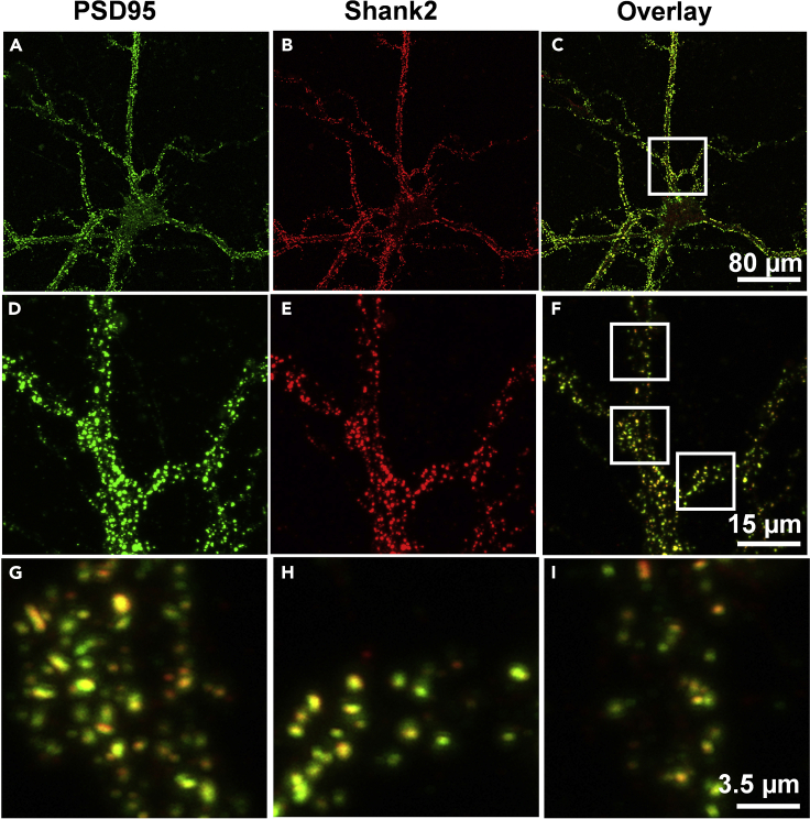 Figure 11