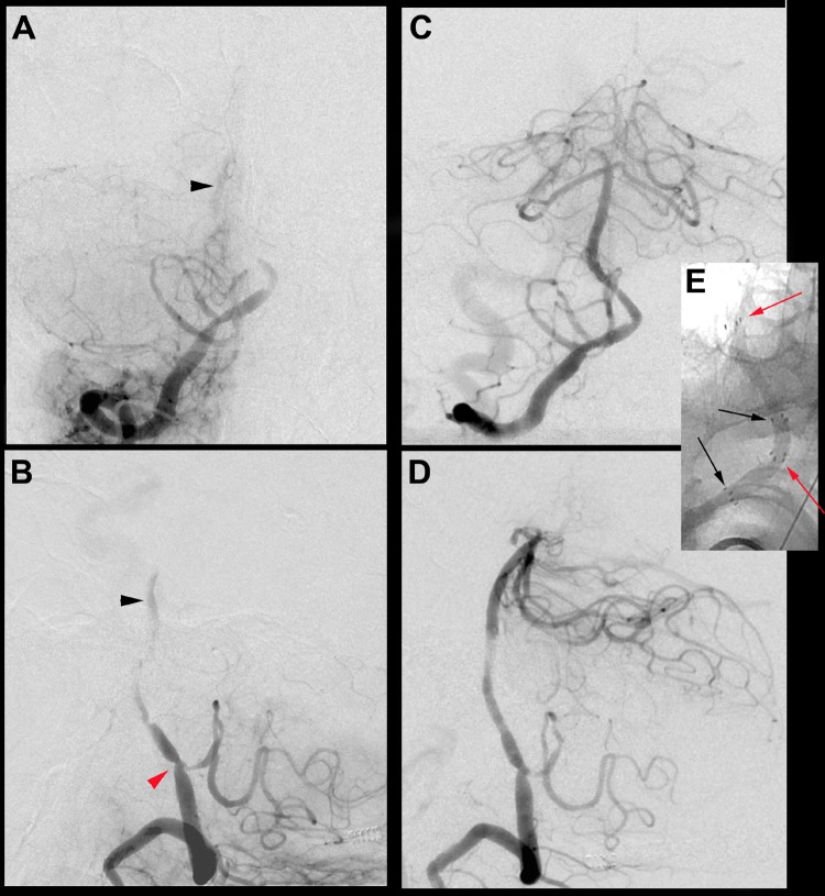 Figure 1