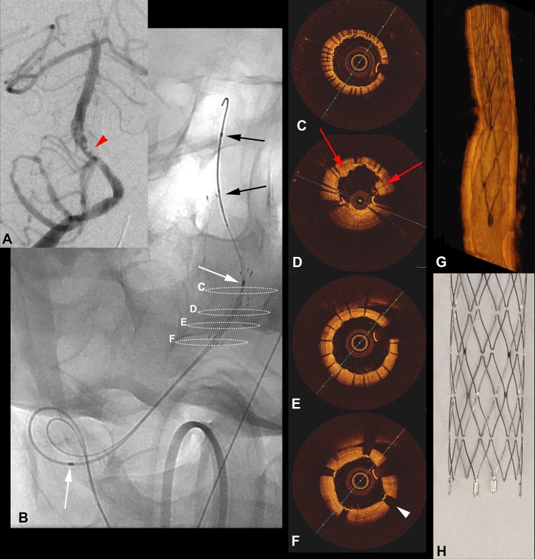 Figure 2