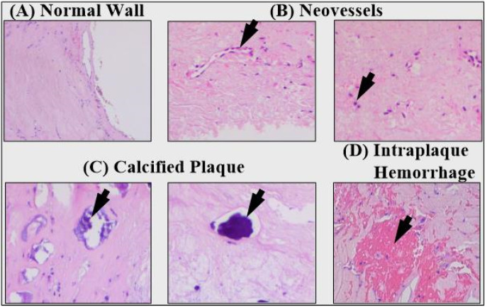 Figure 19