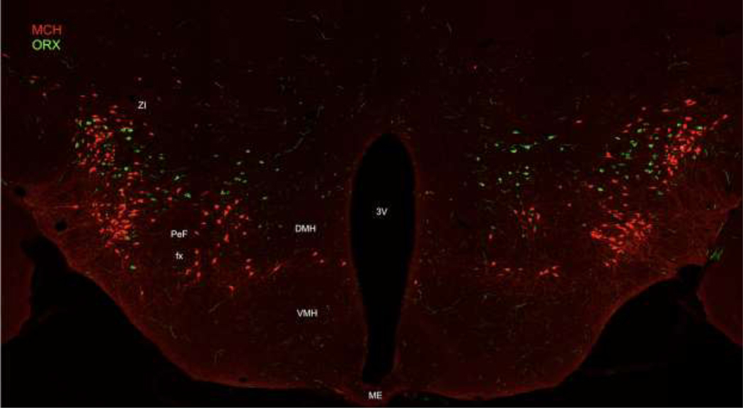 Figure 1: