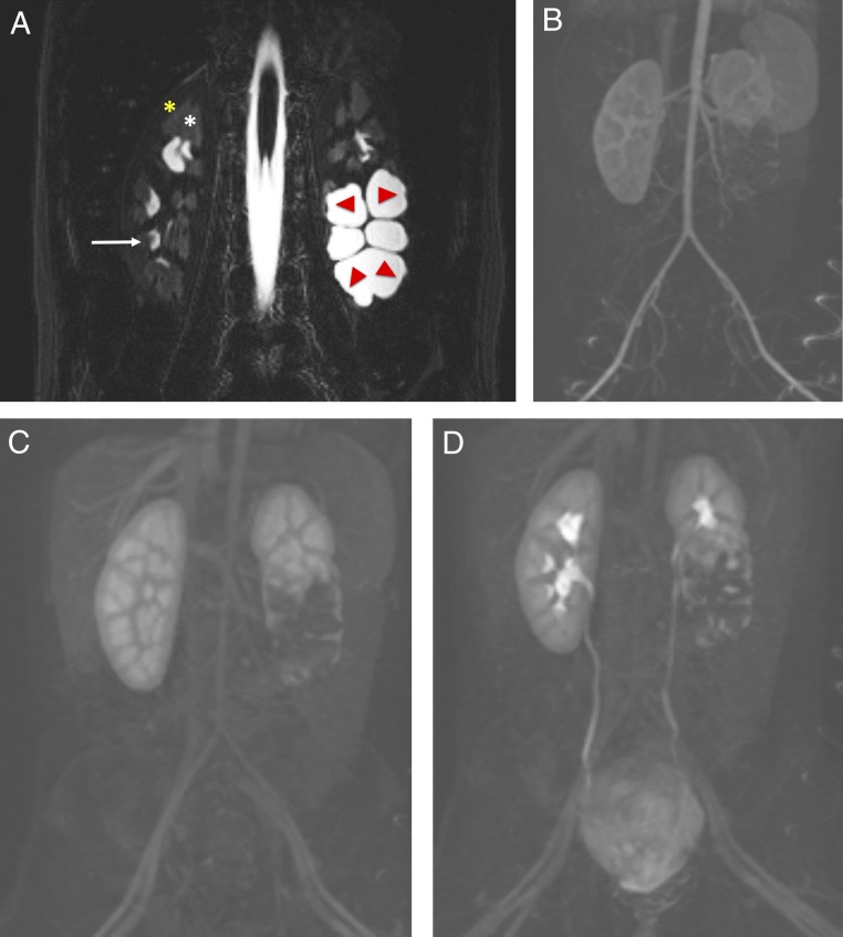 FIGURE 12