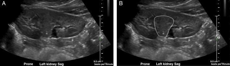 FIGURE 3