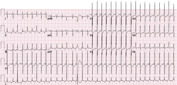 Figure 1