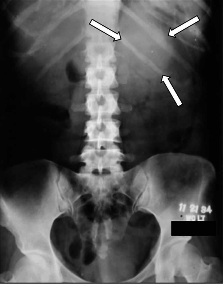 Fig. 1