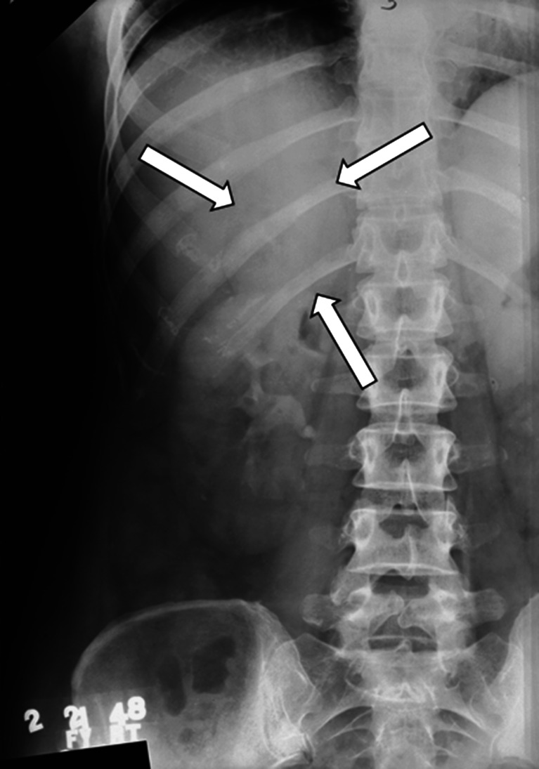 Fig. 2