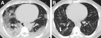 Fig. 17