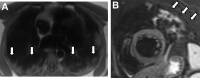 Fig. 10