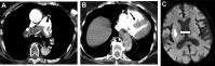 Fig. 13
