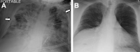 Fig. 15