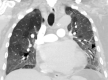 Fig. 7