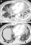 Fig. 16