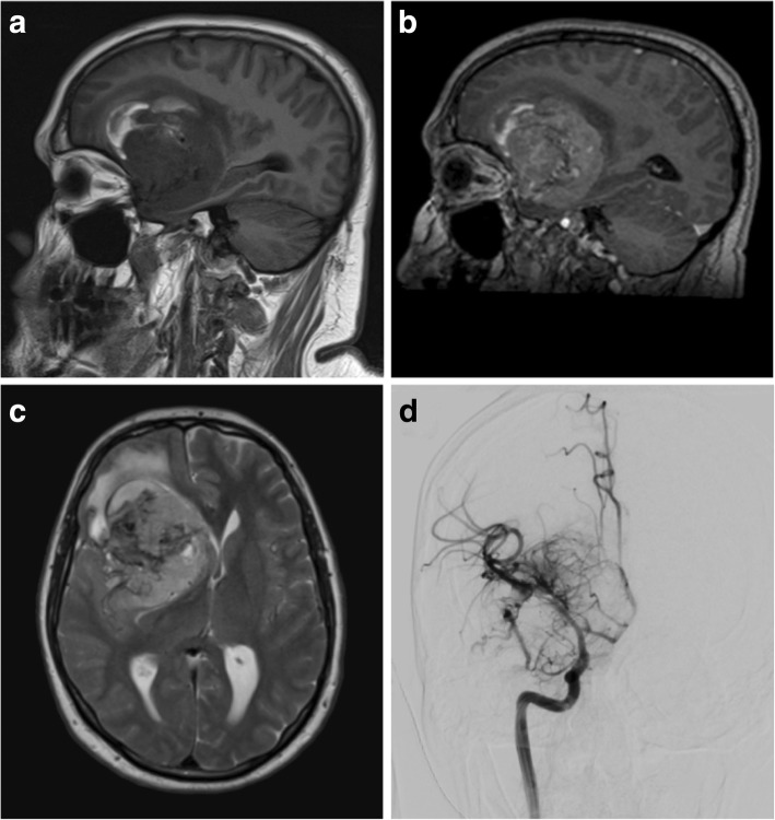 Fig. 10