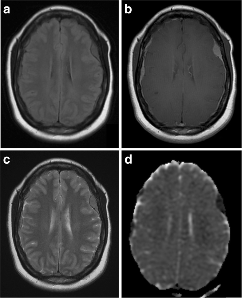 Fig. 9