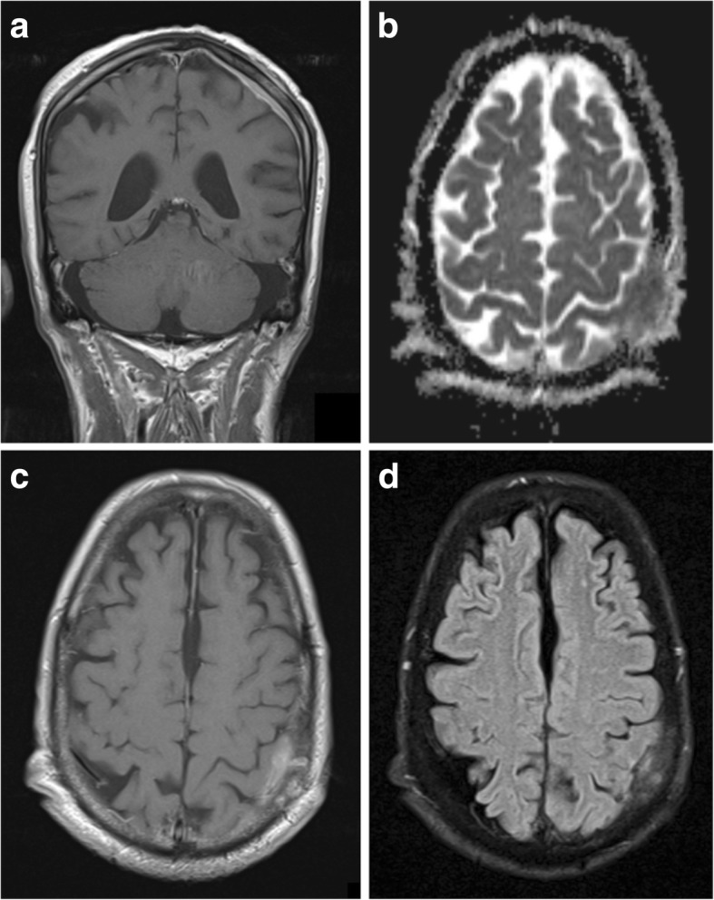 Fig. 13