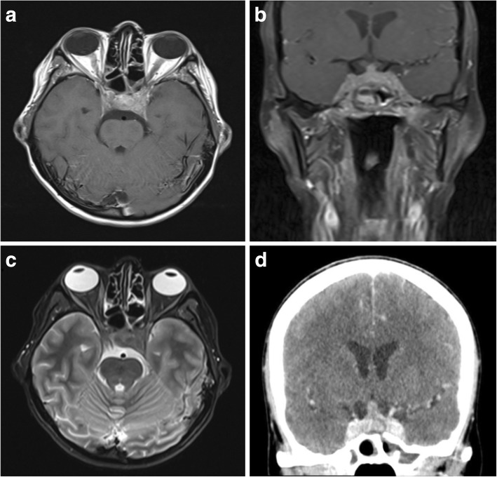 Fig. 12