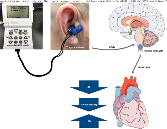 Figure 1: