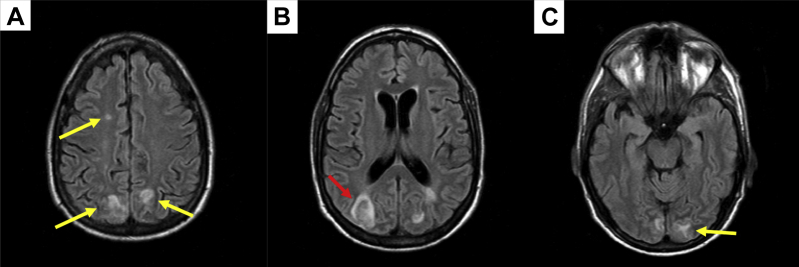 Figure 2